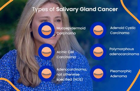 parotid gland tumor pictures